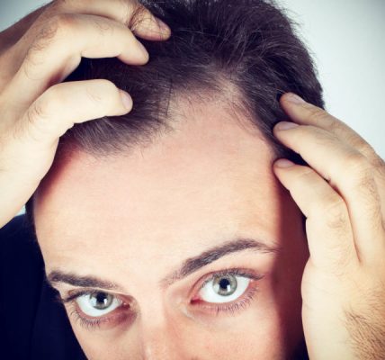 Reasons to Get a Hair Loss Treatment Today