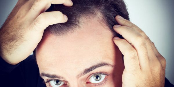 Reasons to Get a Hair Loss Treatment Today