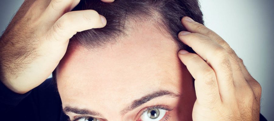 Reasons to Get a Hair Loss Treatment Today