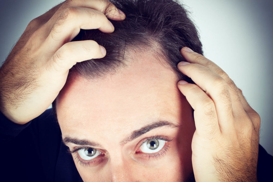 Reasons to Get a Hair Loss Treatment Today